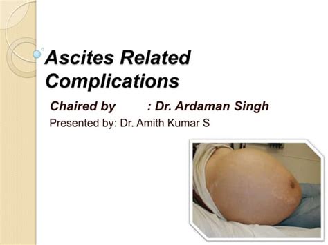 Ascites related complications final | PPT