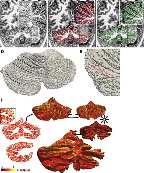 A Whole Cerebellar Cortex T Weighted Image Mm Isotropic Boxes