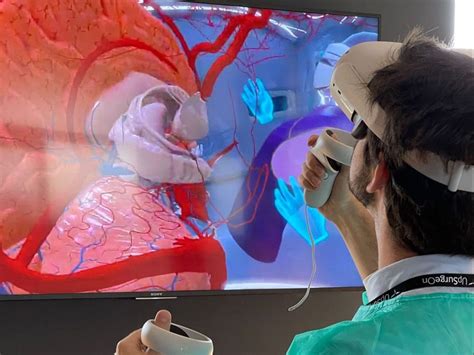 Unveiling The Realm Of Surgical Simulation Upsurgeon