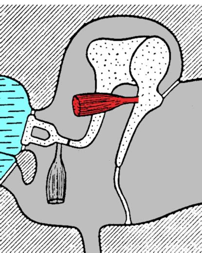 Tensor Tympani And Stapedius Myoclonus