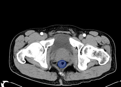 A Systematic Approach To The Interpretation Of Ct Abdomenpelvis