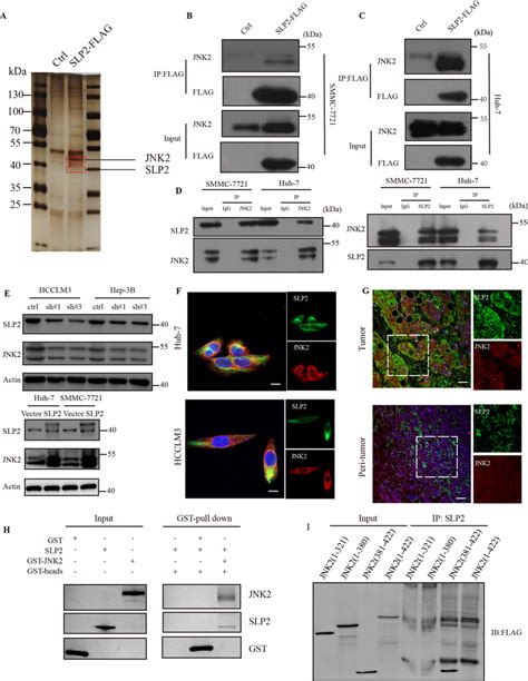 Slp2 Could Interact With The C Terminus Of Jnk2 A Total Cell Lysate Was