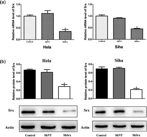 Sulfiredoxin May Promote Metastasis And Invasion Of Cervical Squamous