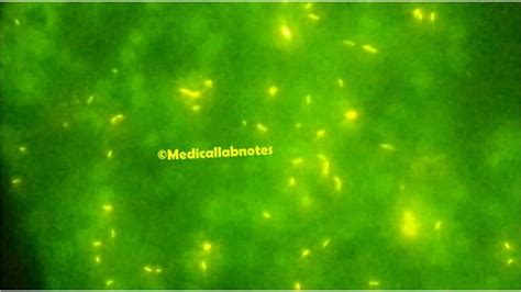 Auramine Phenol Stain Introduction Principle