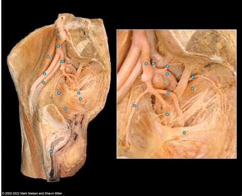 Branches Of The Internal Iliac Artery Diagram Quizlet