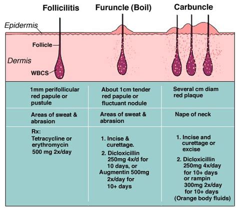 Folliculitis Causes, Pictures and Treatment