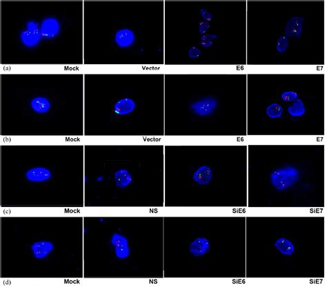 Hpv E E Upregulate Hterc Mrna And Gene Amplification Levels By