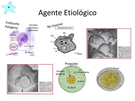 Amebiasis Intestinal