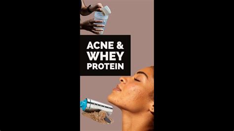 Acne And Whey Protein What You Need To Know Dr Manisha Mareddy