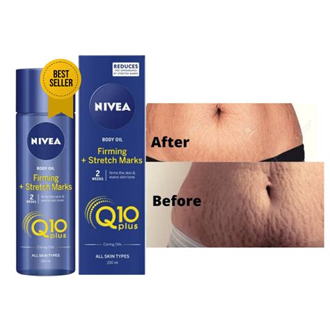 NIVEA Body Oil Firming Stretch Marks 200ML Lazada PH