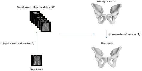 Sex Estimation From Coxal Bones Using Deep Learning In A Population Balanced By Sex And Age