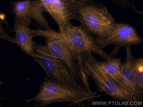 Beta Actin antibody (CL555-81115) | Proteintech