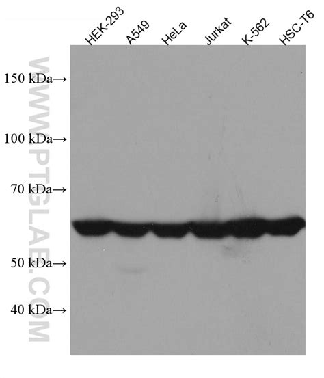 CCT8 antibody 67539 1 Ig Proteintech 武汉三鹰生物技术有限公司