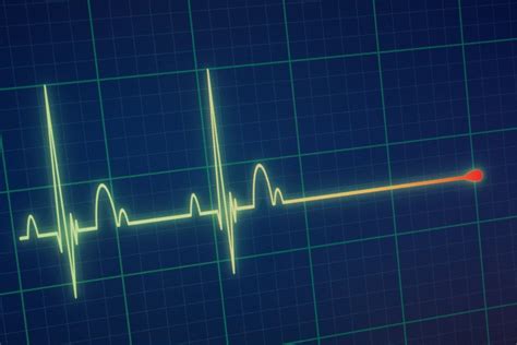 Langzeit EKG 24 Stunden bis 7 Tage Herzüberwachung