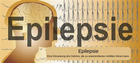 Grad Der Behinderung Bei Epilepsie Gdb Tabelle Antrag