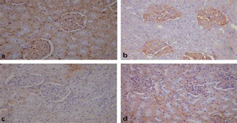 PECAM 1 Expression Showing Normal Pattern Of Expression In Both Of