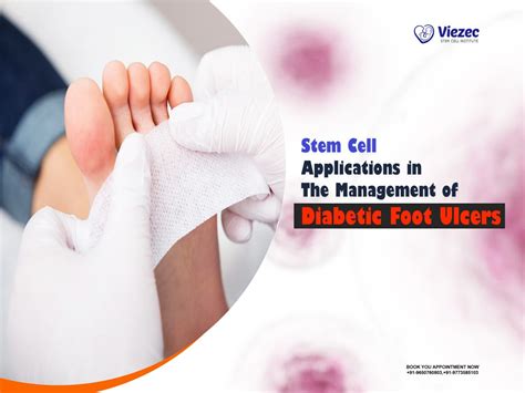 Stem Cell Applications In Management Of Diabetic Foot Ulcers