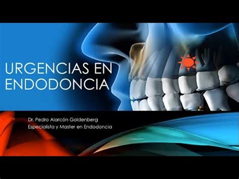 Urgencias En Endodoncia Youtube