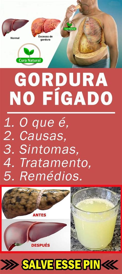 Como Eliminar a Gordura no Fígado em 8 Dias Remedios para o figado