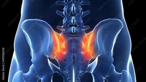 3d Rendered Illustration Of A Painful Sacroiliac Joint Stock