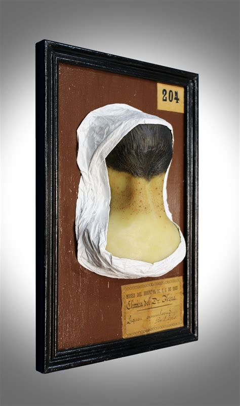 Liquen espinuloso - Museo Olavide