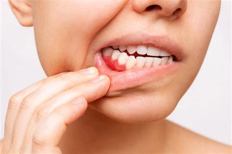 How To Keep Your Gums Healthy Dr Salim Kapadia Dental Centre