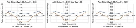 Bcla Clear Presbyopia Management With Corneal Techniques Contact