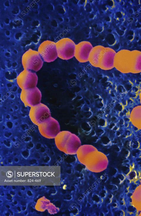 Streptococcus A Superstock