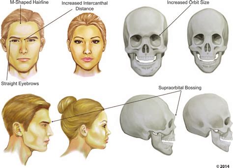 Masculine Vs Feminine Facial Features