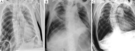 Serial Radiographs During The Patient S Hospitalization A First