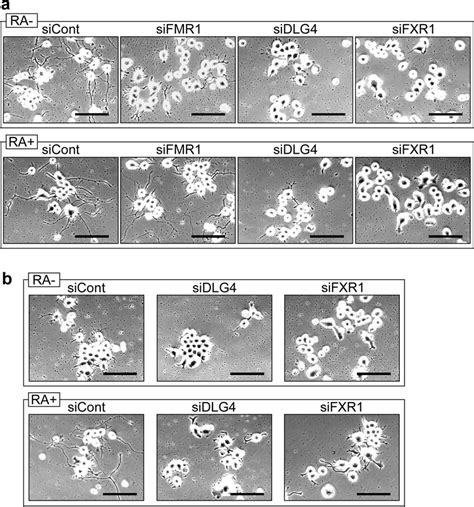 Process Formation Of N2a Cell A N2a Cells With Gene Knockdown Under Download Scientific