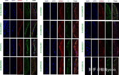 单细胞文献阅读：the Adult Human Testis Transcriptional …… 知乎