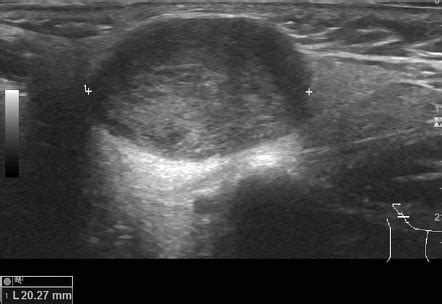 Radiology Quiz 82030 Radiopaedia Org