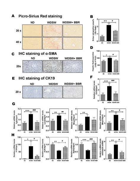 Effect Of BBR On NASH Associated Hepatic Fibrosis A Representative