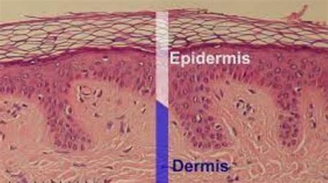 Kumpulan Berita Cara Merawat Epidermis 7 Fungsi Epidermis Di Kulit