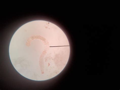 Worm and Worm Eggs - Microscope Pictures and a Treatment Tale ...