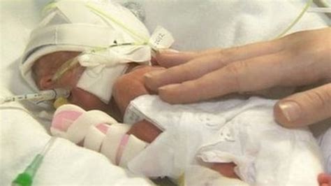 Born Too Soon What Is The Outlook For Severely Premature Babies