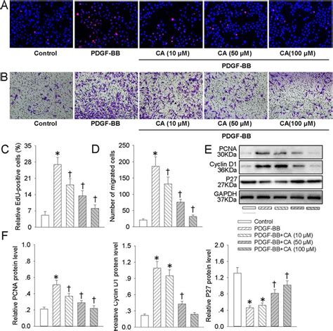 Ca Abated Pdgf Bb Induced Vsmc Proliferation And Migration Vsmcs Were