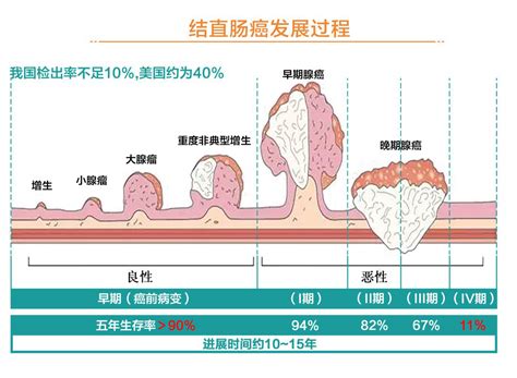 结直肠癌 安龙基因