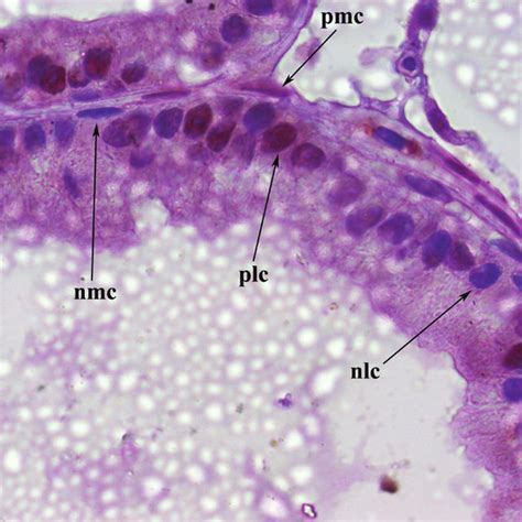 Immunohistochemical Localisation Of Androgen Receptor Ar In Prostate