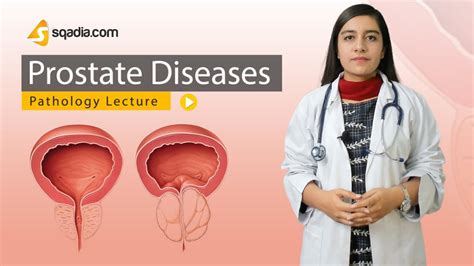 Prostate Diseases Pathology Video Lectures Medical Online Education