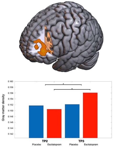 Increased Left Dorsolateral Prefrontal Cortex Density Following