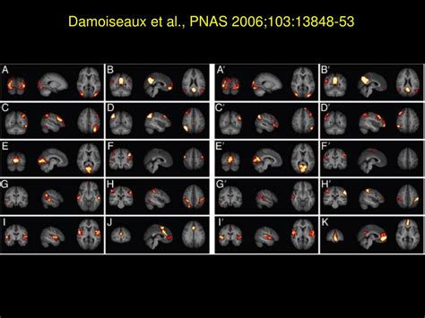 Ppt Resting State Fmri Rs Fmri Fcmri Physiological Underpinnings