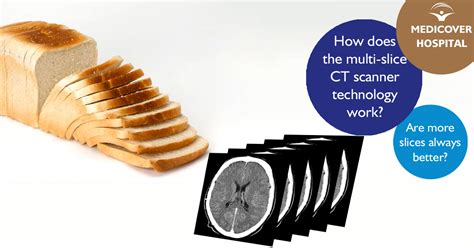 How Does The Multi Slice Ct Scanner Technology Work H Medical