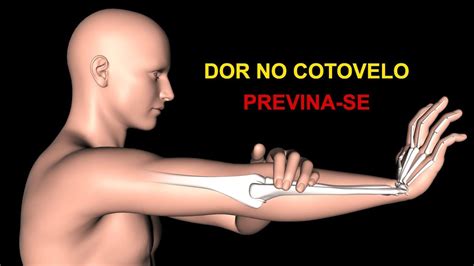 EPICONDILITE Exercícios que ajudam a prevenir e aliviar a dor no