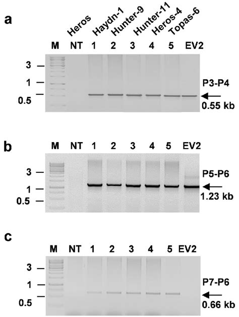 Photographs Of Ethidium Bromide Stained Agarose Gels With Pcr