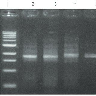 Diatoms subjected to " bead beating " as a part of the DNA extraction... | Download Scientific ...