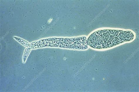 Lm of cercarial larva - Stock Image - Z160/0011 - Science Photo Library 