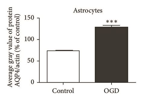 AQP4 knockdown inhibited OGD-induced primary astrocyte injury. (a ... 
