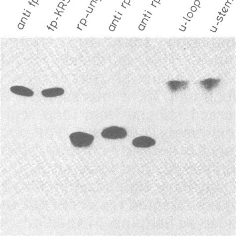 Electrophoresis Of 5 32p End Labelled Oligonucleotides On A Denaturing